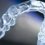 Invisalign, la ortodoncia invisible