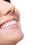 Beneficios del blanqueamiento dental
