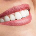 ¿Cuándo es necesario realizar una endodoncia?