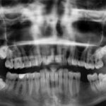 El escaner dental 3D para mejores diagnósticos