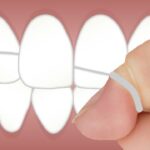 Hilo dental o enjuague bucal. ¿Cuál es mejor?