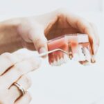 Cuidados después de los implantes dentales