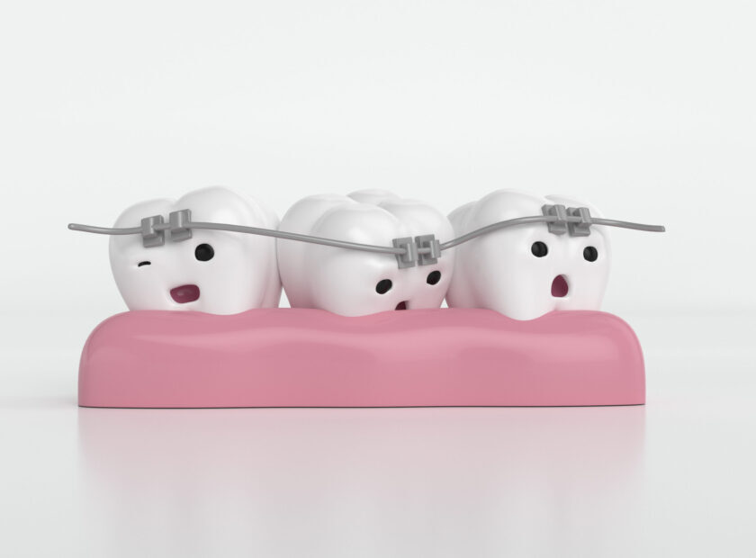 Orthodontic teeth or dental braces - tooth cartoon 3d cute character with white background