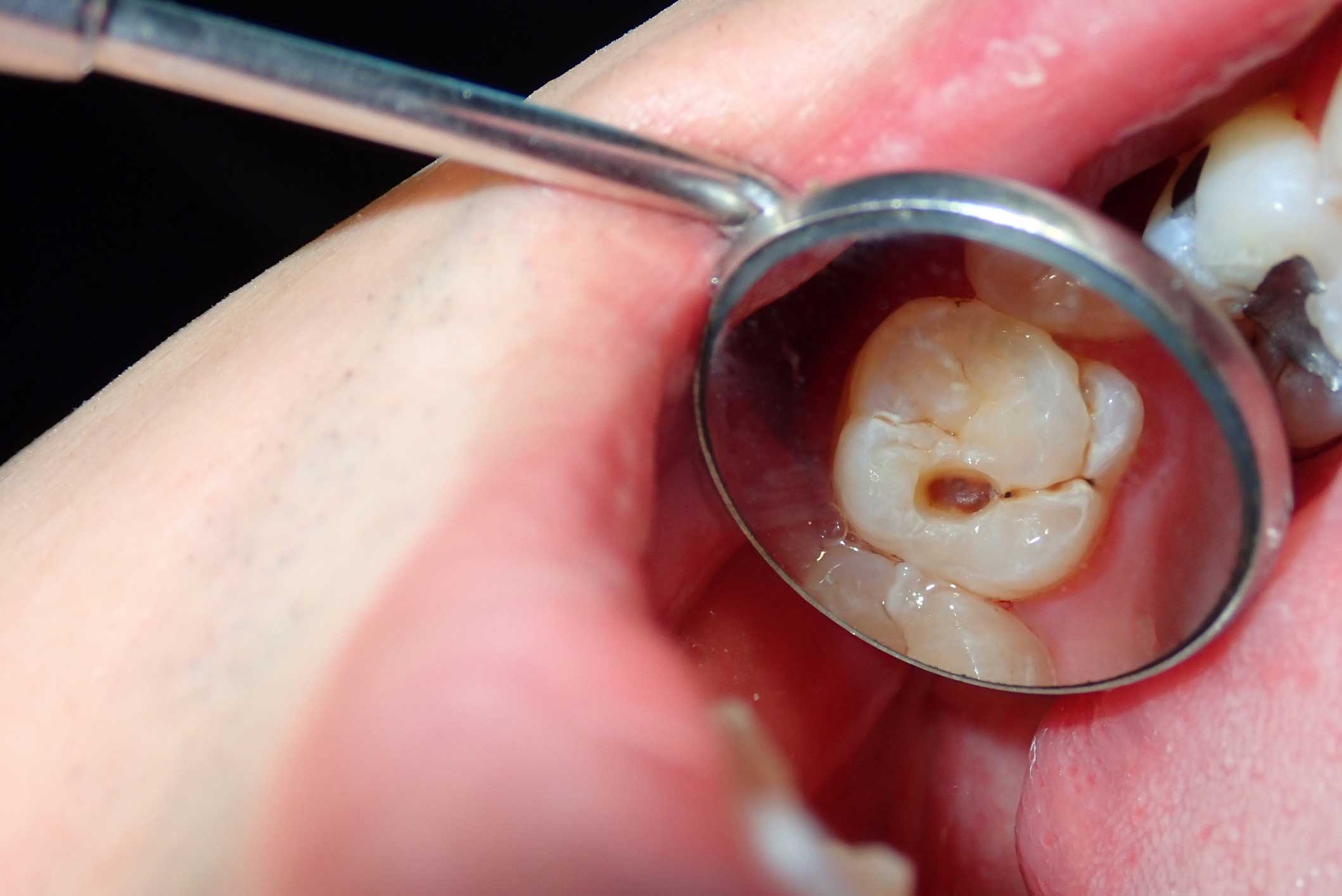 odontología en Terrassa