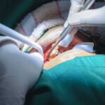 Cirugía oral y maxilofacial