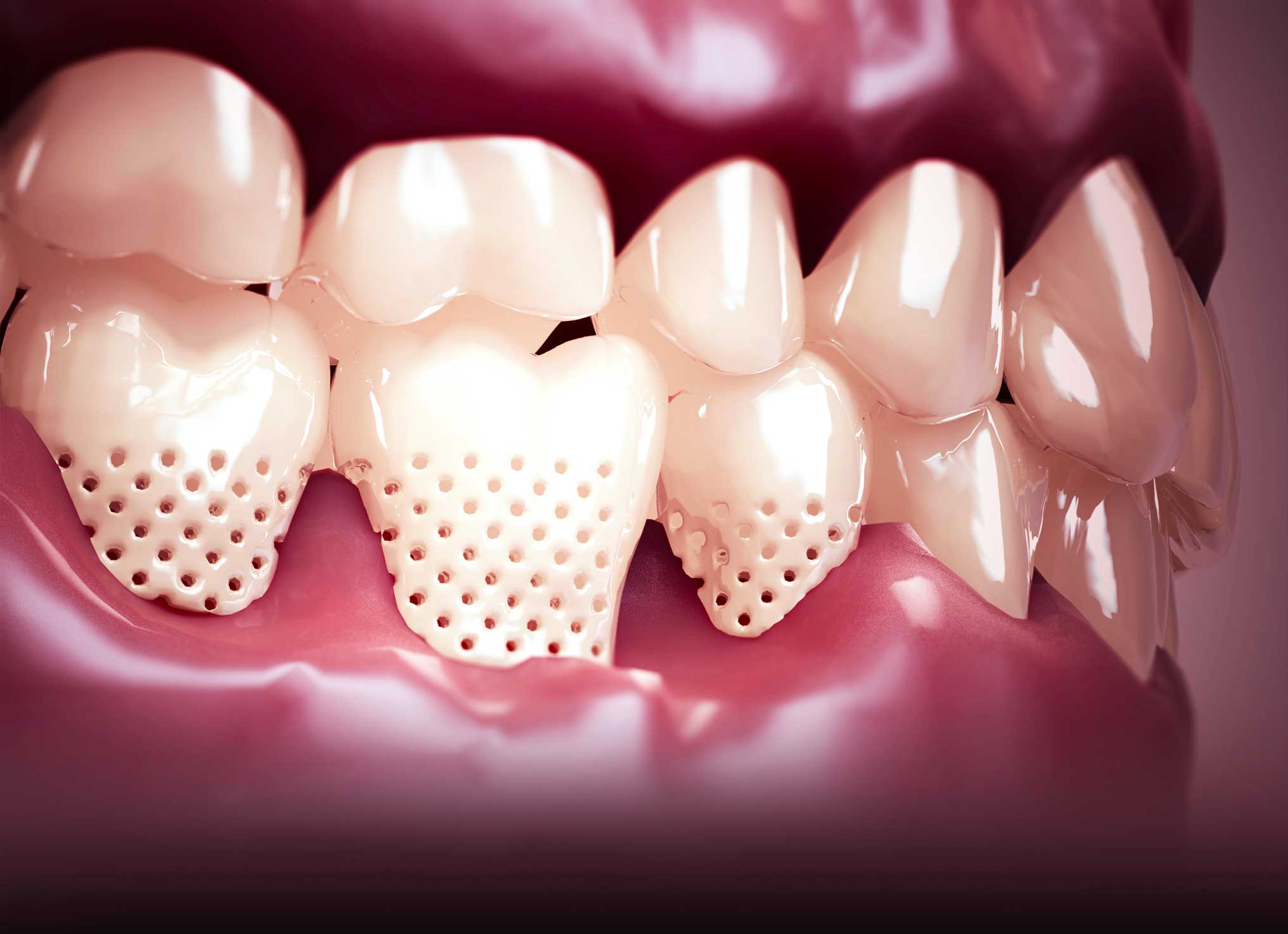 cirugía oral y maxilofacial en Terrassa