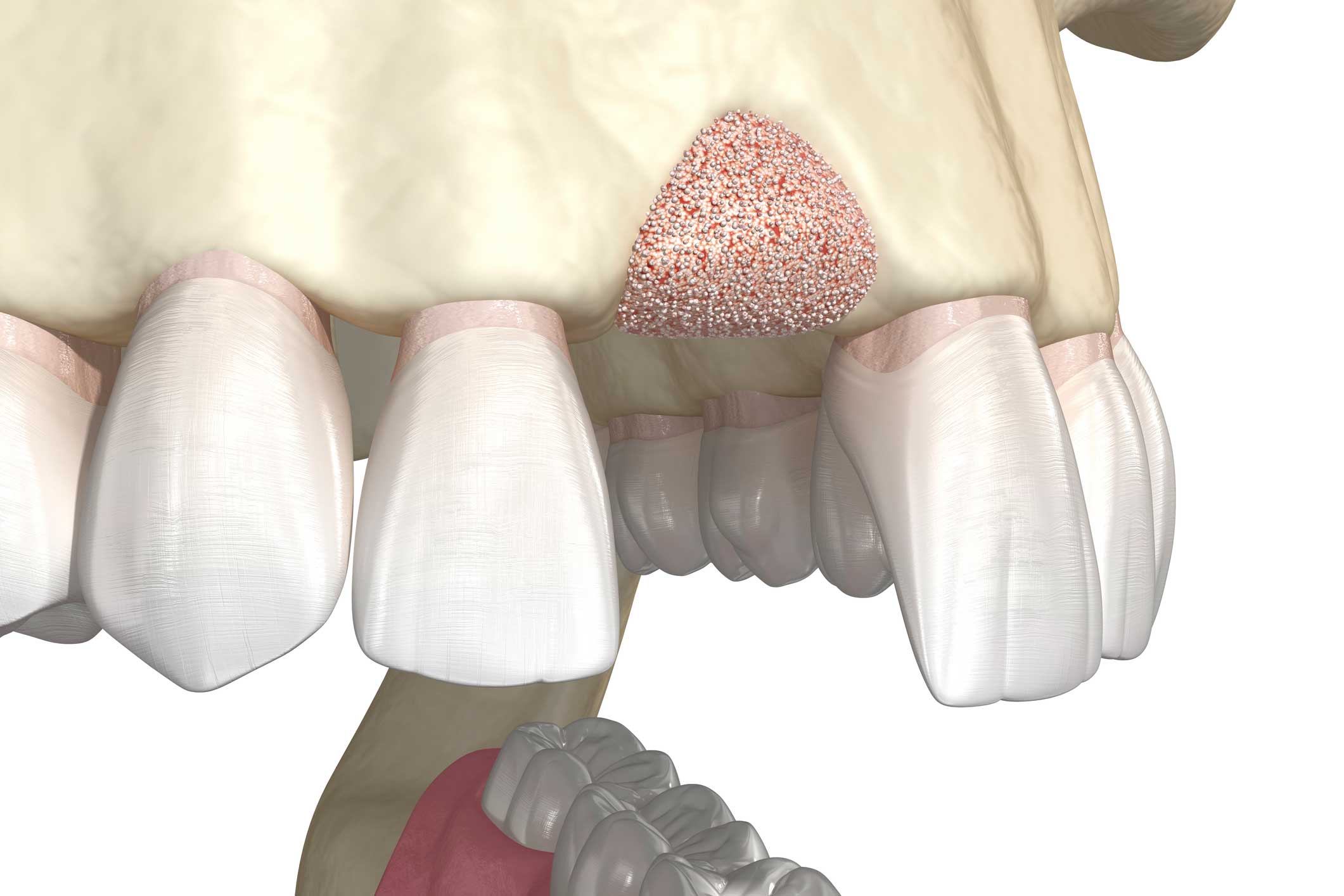 cirugía oral y maxilofacial en Terrassa