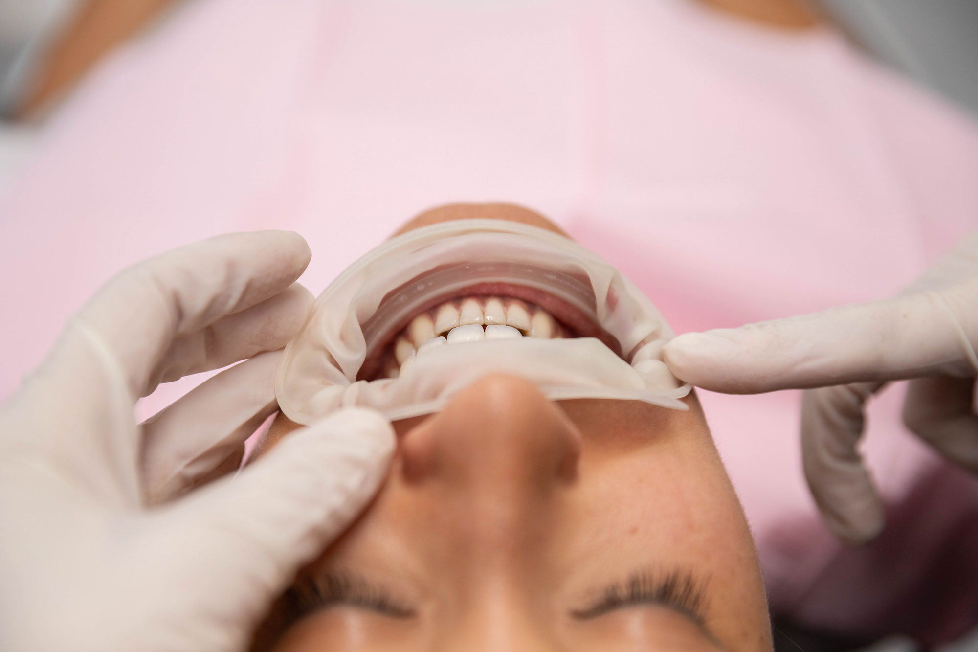 estética dental en Terrassa