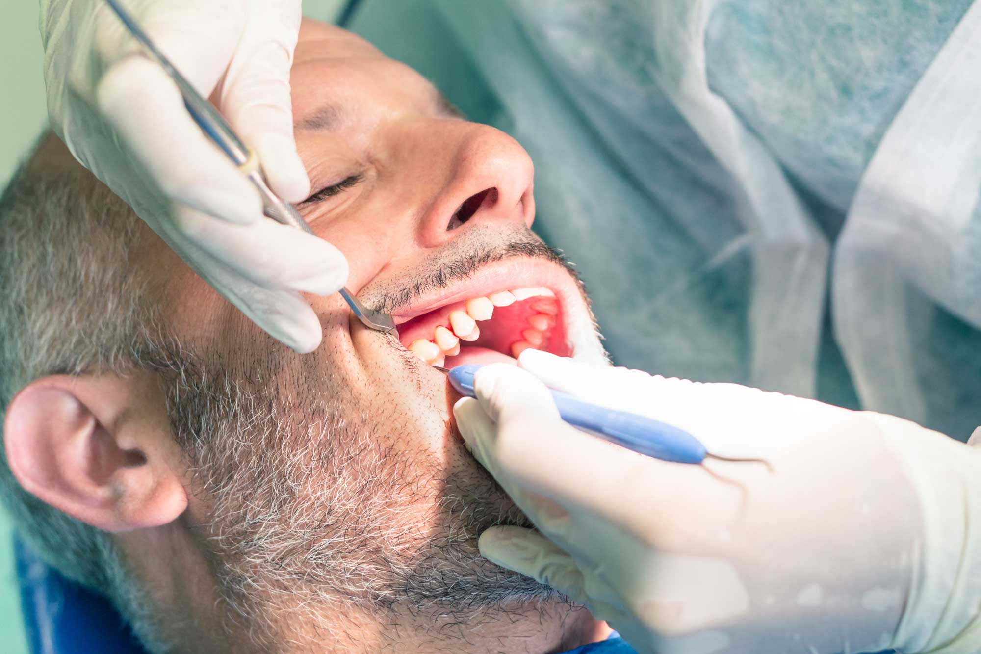 cirugía oral y maxilofacial en Terrassa