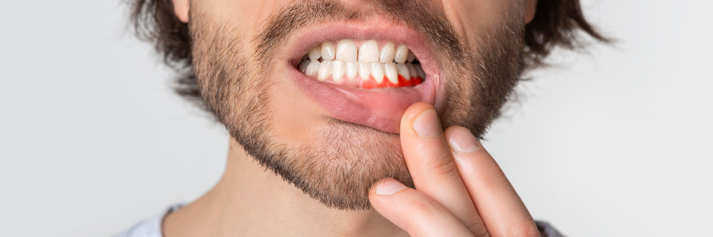 periodoncia en Terrassa