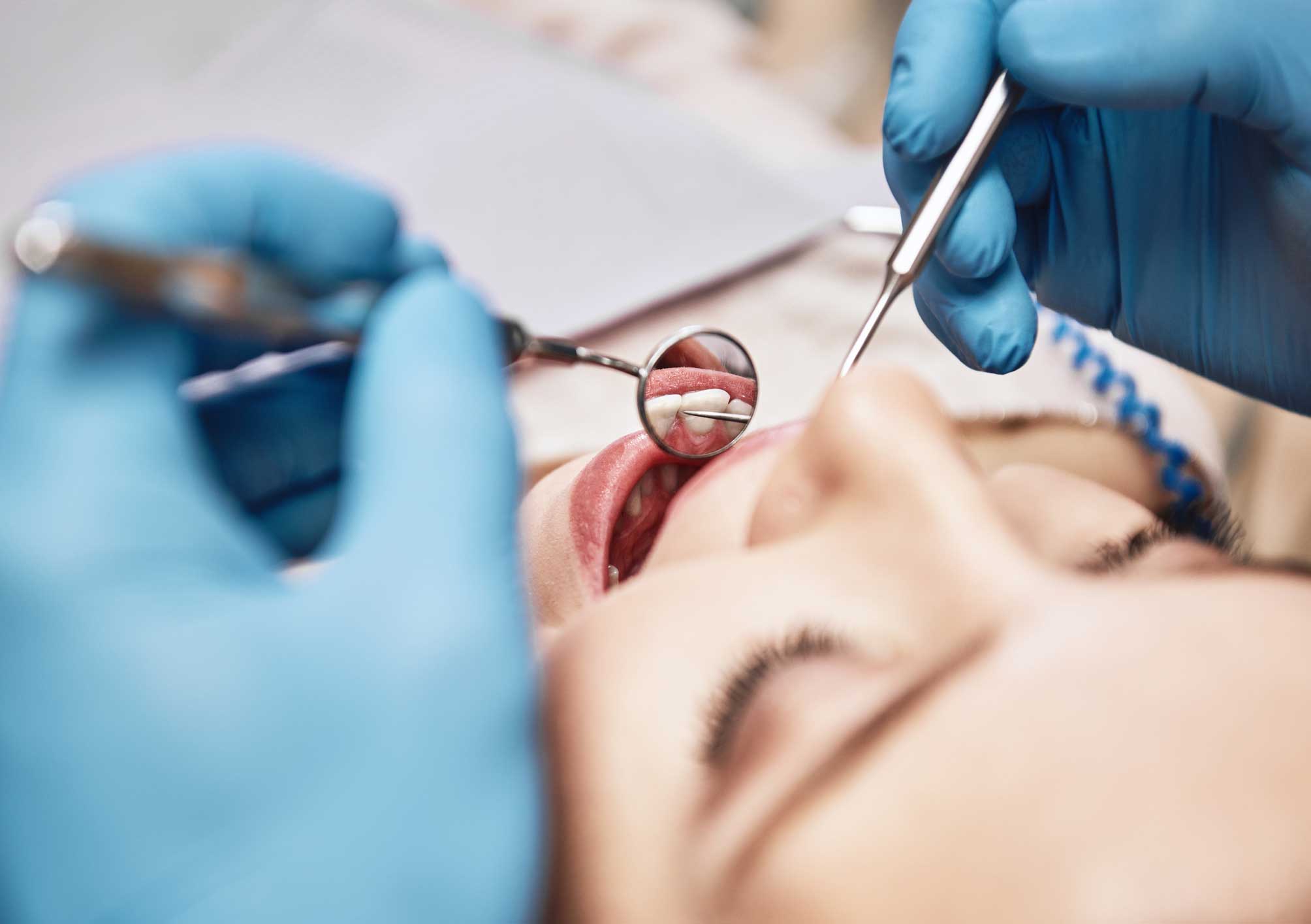 implantología en Terrassa, implantes dentales en Terrassa