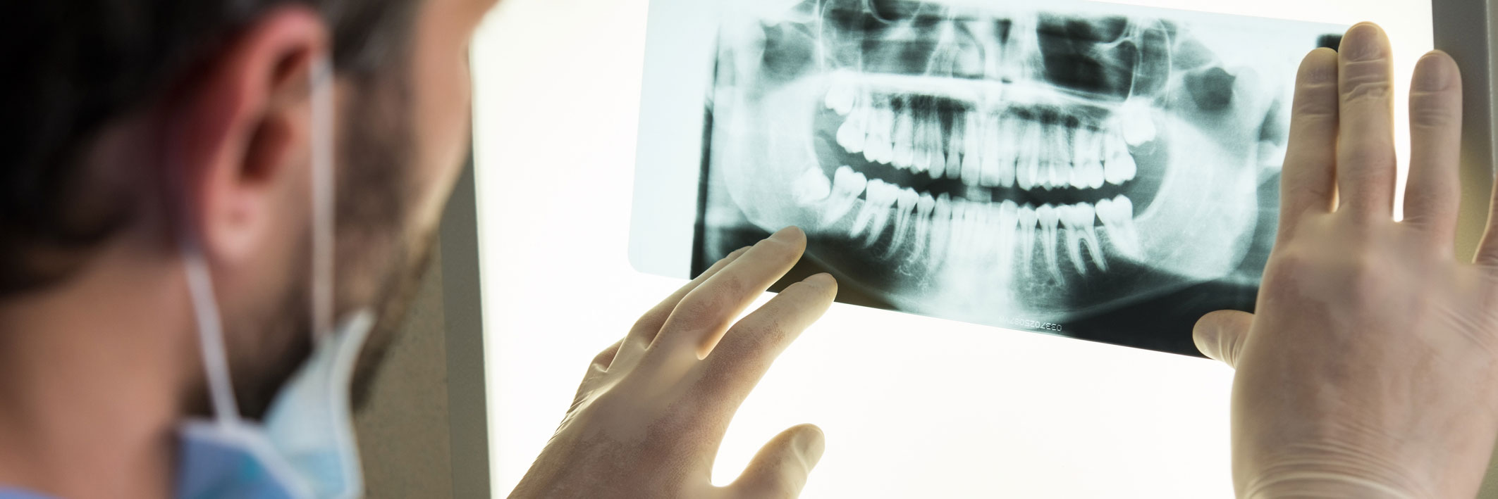 cirugía oral y maxilofacial en Terrassa