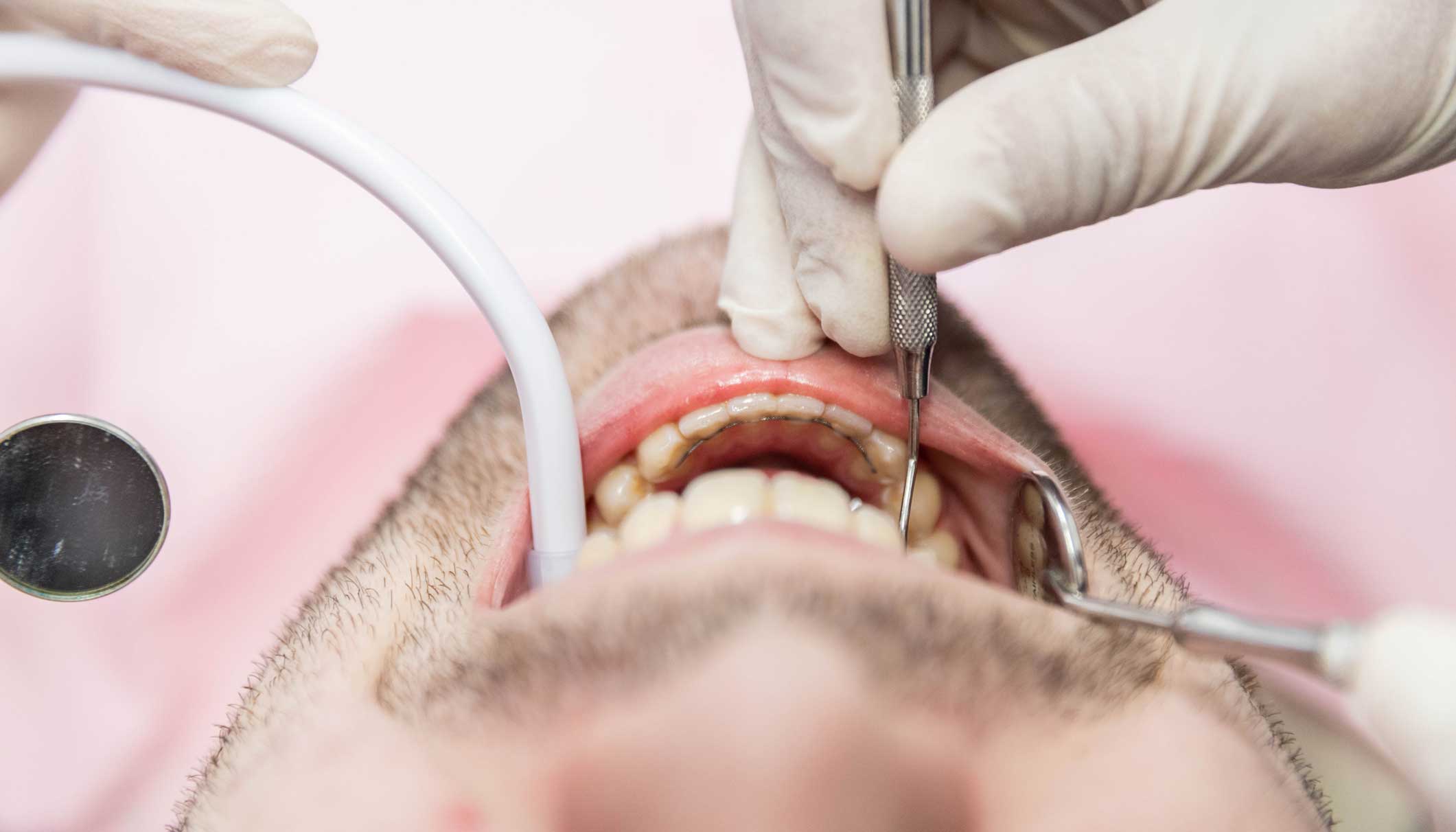 ortodoncia en Terrassa, clínica dental en Terrassa