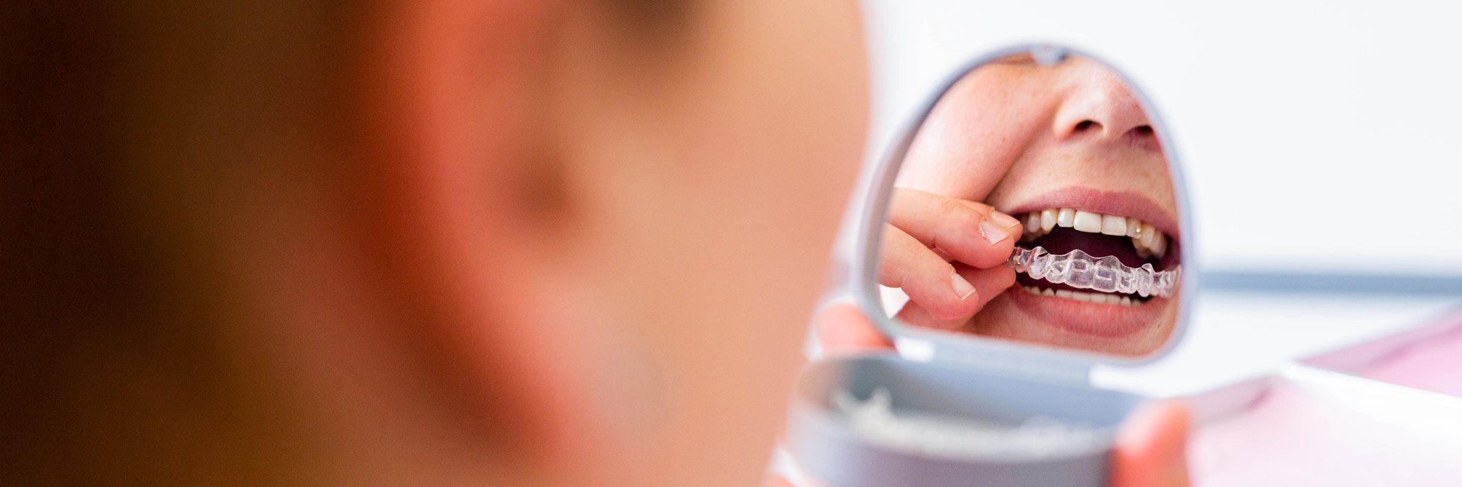 ortodoncia en Terrassa, clínica dental en Terrassa