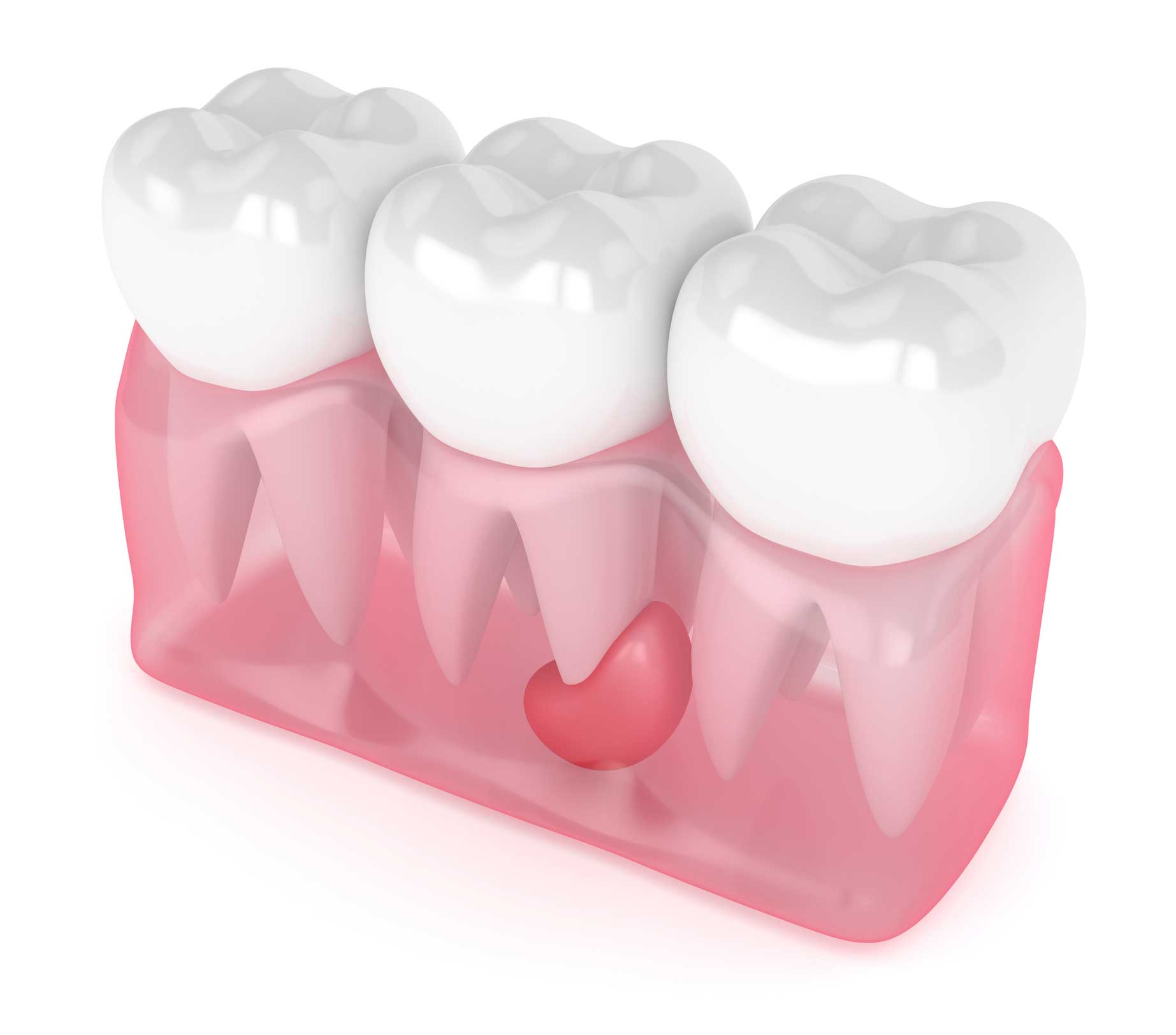 cirugía oral y maxilofacial en Terrassa